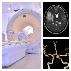 脳ドック(頭部MRI/MRA+頭頚部MRA)