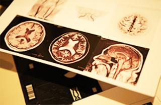 【MRSO価格】脳検査(頭・頸部MRI/MRA、頸動脈エコー)11