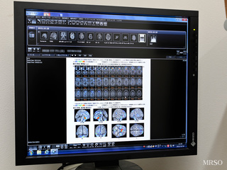 【当日の結果説明】脳ドック標準コースB(頭部MRI/MRA+認知症検査「脳萎縮解析(VSRAD)」)11