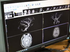 【脳ドック認定施設による】脳MRI・MRA+頸動脈エコーセットコース11