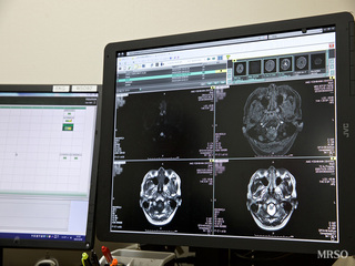 ◇胃カメラ◇人間ドック(腫瘍マーカー付き)+脳検査(頭部MRI・MRA、頸動脈エコー、頸部MRA)11