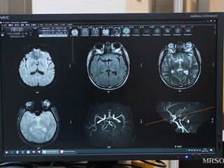 脳MRI/MRA単独コース11