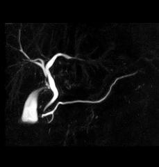 【土日祝も受けられる】胆膵MRIドック(MRCP)