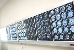 【1.5テスラ】脳ドックプラス(当日結果説明有)◆脳MRI・MRA+専門医による問診・結果説明◆11