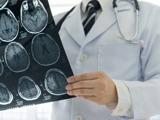 2020年4月～　脳ドック(頭部MRI+頸動脈・頭蓋内動脈MRA検査)+認知症ドック11
