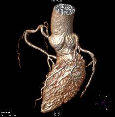 プレミアム心臓ドック【心臓MRI・冠動脈MRA・頭部MRI/MRA・心臓エコー・頸動脈エコー・動脈硬化検査+人間ドック】11