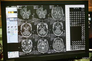 プレミアムレディースドック(人間ドック+脳ドック+乳がん+子宮がん検査)