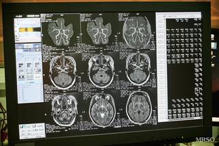 【14周年記念初回の方】脳ドック(MRI・MRA)11