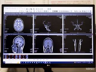 【脳ドック】(頭部MRI・MRA&頸部MRI・MRA+認知機能・血液検査)11