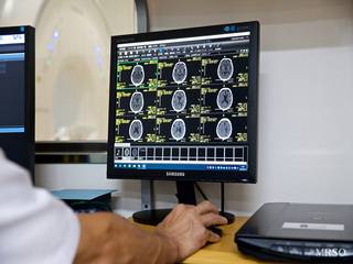 お仕事帰りにも受診可能な脳ドック(MRI+MRA+頸動脈MRA+脳体積133部位実測)《事前カード決済のみ》11