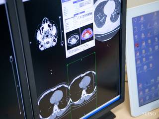 【女性向け】頭部・胸部CT、乳がん検診、腫瘍マーカー4種類付き人間ドック