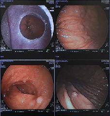 《胃の調子が悪い、胃が気になる方にオススメのプランです》胃カメラコース(スタンダードコース+上部消化管内視鏡検査)11