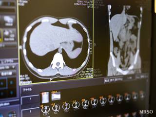 【鎮静剤選択可能】胃カメラドック+全身CT+腫瘍マーカー11