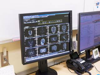 【脳ドック】脳・血管コース(脳MRI+脳MRA+頚部MRA+頚動脈超音波エコー検査)