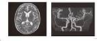 【K】PET-CT総合+脳ドックコース(腹部エコー・胸部CT・血液検査付き)11