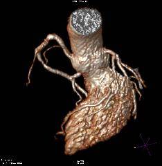 MRI心臓フルドック【心臓MRI・冠動脈MRA・心臓エコー・頸動脈エコー・動脈硬化検査+健康診断】
