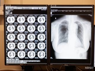 【7～12月受診】選べる脳検査【胃検査は鎮静剤使用の内視鏡】スタンダードドック