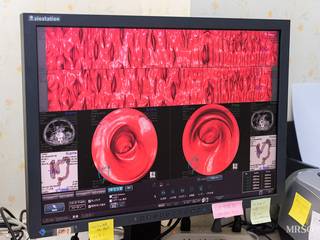 ◆全額自己負担◆大腸がん検診(大腸3DCT検査)