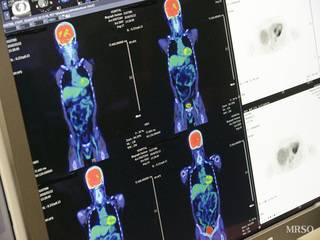 エグゼクティブフルドック(PET/CT・腫瘍マーカー・エコー)