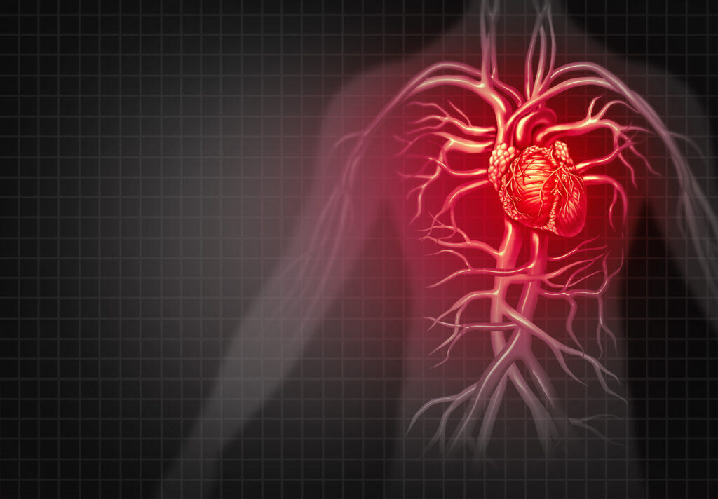 狭心症 心筋梗塞の検査と費用 心臓ドックで心臓病を予防 人間ドックのミカタ