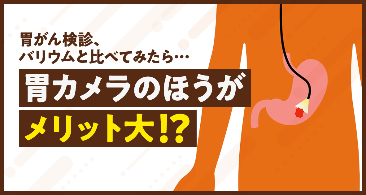 胃カメラとバリウム比較