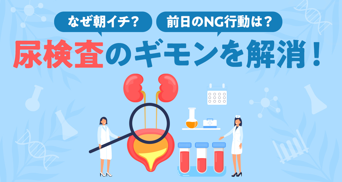 尿検査のギモンを解消