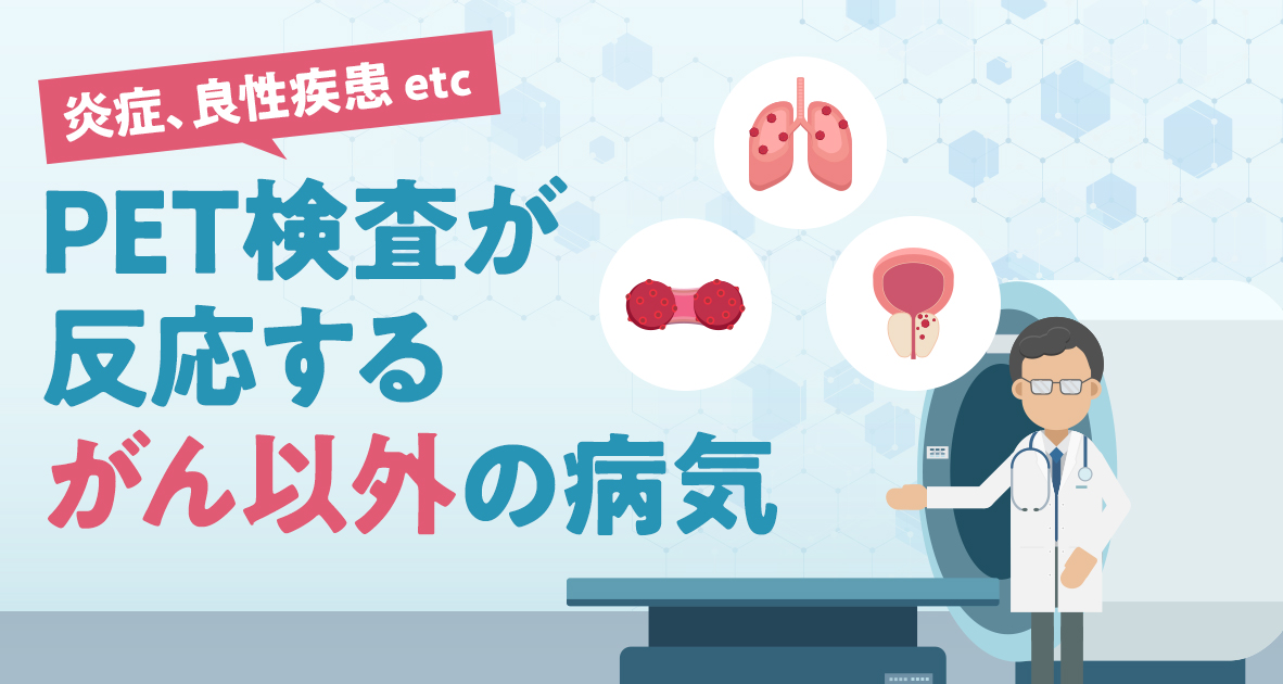 PET検査が反応するがん以外の病気