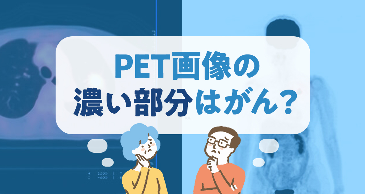 PET画像の濃い部分はがん？