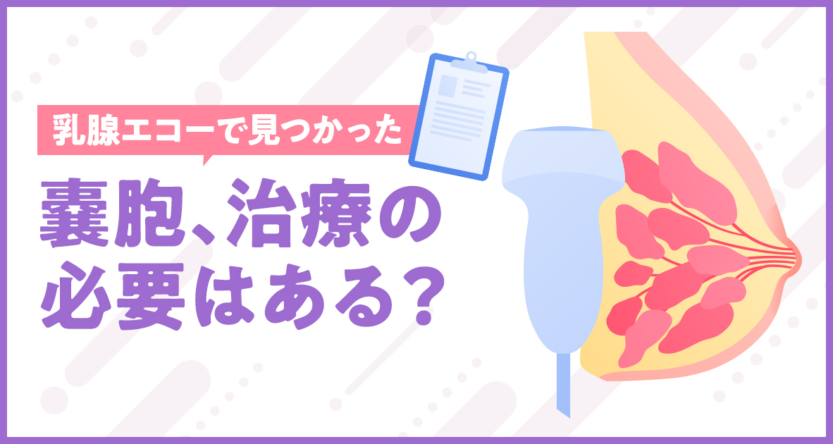 乳腺エコーで見つかった嚢胞、治療の必要はある？