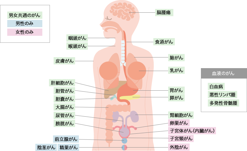 がんのできる部位と種類
