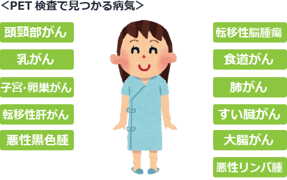 PET検査で見つけることができる病気