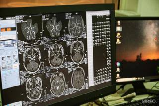 胃カメラ(鎮静剤使用)人間ドック+MRI脳ドック11